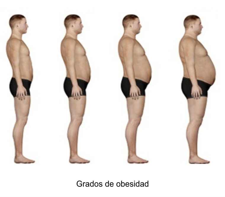 Dr. Antonio Lahoud | Cirujano bariátrico y metabólico. | Obesidad | Lima - Perú
