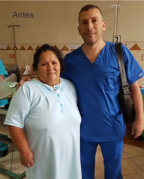 Dr. Antonio Lahoud | Cirujano bariátrico y metabólico. | Testimonios | Rayda Vargas antes de la cirugía de manga gástrica | Lima - Perú